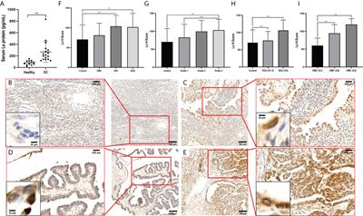 La protein regulates protein expression by binding with the mRNAs of target genes and participates the pathological process of ovarian cancer